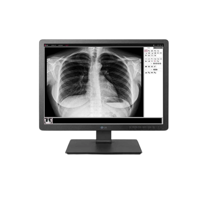 MONITOR DE REVISIÓN CLÍNICA 19HK312C